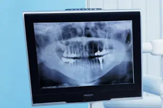 Digital Xrays & Imaging