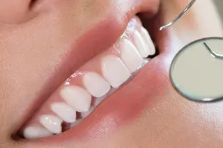 Periodontal Therapy & Gum Grafting