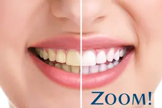 Zoom Whitening