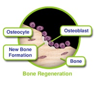 Bone Grafting Regeneration 