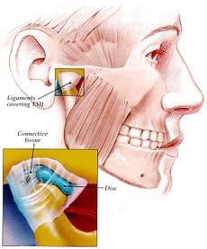 TMJ Therapy