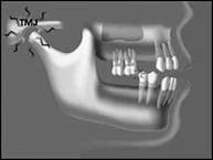 Jaw Bone X-ray